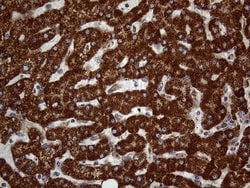 DECR1 Mouse anti-Human, Clone: OTI5D6, lyophilized, TrueMAB 100 &mu;g;
