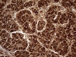 DECR1 Mouse anti-Human, Clone: OTI5D6, lyophilized, TrueMAB 100 &mu;g;