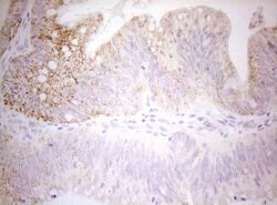 DECR1 Monoclonal Antibody (OTI8F11), TrueMAB , OriGene 100 &mu;L; Unconjugated:Antibodies,
