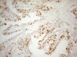 DECR1 Monoclonal Antibody (OTI8F11), TrueMAB , OriGene 100 &mu;L; Unconjugated:Antibodies,