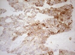 DECR1 Monoclonal Antibody (OTI8F11), TrueMAB , OriGene 100 &mu;L; Unconjugated:Antibodies,