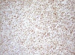 DECR1 Monoclonal Antibody (OTI8F11), TrueMAB , OriGene 100 &mu;L; Unconjugated:Antibodies,
