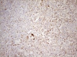 DECR1 Monoclonal Antibody (OTI8F11), TrueMAB , OriGene:Antibodies:Primary