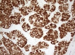 DECR1 Monoclonal Antibody (OTI8F11), TrueMAB , OriGene 100 &mu;L; Unconjugated:Antibodies,