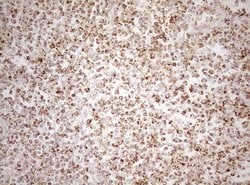 DECR1 Monoclonal Antibody (OTI5D12), TrueMAB , OriGene 30 &mu;L; Unconjugated:Antibodies,