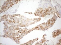 DECR1 Monoclonal Antibody (OTI4G4), TrueMAB , OriGene 100 &mu;L; Unconjugated:Antibodies,