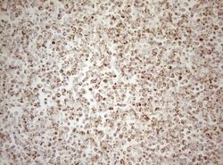 DECR1 Monoclonal Antibody (OTI4G4), TrueMAB , OriGene 100 &mu;L; Unconjugated:Antibodies,