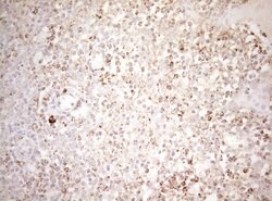 DECR1 Monoclonal Antibody (OTI4G4), TrueMAB , OriGene 100 &mu;L; Unconjugated:Antibodies,