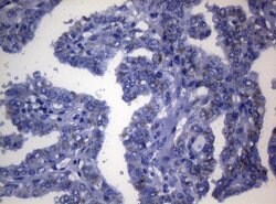 DECR1 Mouse anti-Human, Clone: OTI10A11, lyophilized, TrueMAB 100 &mu;g;