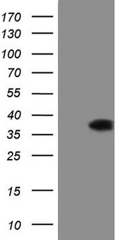 DECR1 Monoclonal Antibody (OTI5D12), TrueMAB , OriGene 30 &mu;L; Unconjugated:Antibodies,