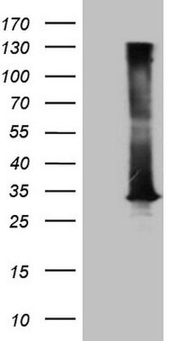 DECR1 Mouse anti-Human, Clone: OTI10A11, lyophilized, TrueMAB 100 &mu;g;