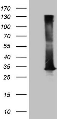 DECR1 Monoclonal Antibody (OTI10A11), TrueMAB , OriGene:Antibodies:Primary