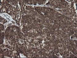 DEF6 Monoclonal Antibody (OTI3F9), TrueMAB , OriGene 30 &mu;L; Unconjugated:Antibodies,