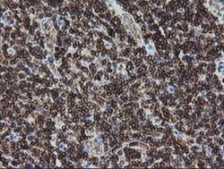 DEF6 Monoclonal Antibody (OTI2C11), TrueMAB , OriGene 100 μL; Unconjugated:Antibodies,