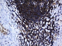 DEF6 Monoclonal Antibody (OTI1D1), TrueMAB , OriGene 100 &mu;L; Unconjugated:Antibodies,