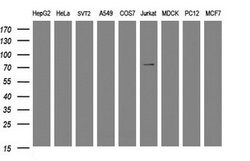 DEF6 Mouse anti-Human, Clone: OTI1D1, lyophilized, TrueMAB 100 &mu;g; Unconjugated:Antibodies,
