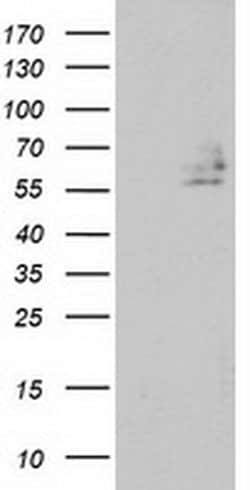 DEF8 Mouse anti-Human, Clone: OTI4B6, liquid, TrueMAB 100 &mu;L; Unconjugated:Antibodies,