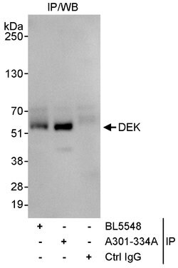 DEK Rabbit anti-Human, Polyclonal, Bethyl Laboratories 100 &mu;L; Unconjugated:Antibodies,