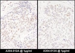 DENTT Rabbit anti-Human, Polyclonal, Bethyl Laboratories 100 &mu;L; Unconjugated:Antibodies,