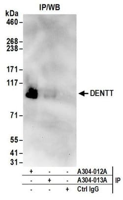 DENTT Rabbit anti-Human, Polyclonal, Bethyl Laboratories 100 &mu;L; Unconjugated:Antibodies,