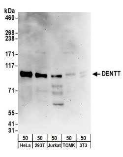 DENTT Rabbit anti-Human, Polyclonal, Bethyl Laboratories 100 &mu;L; Unconjugated:Antibodies,