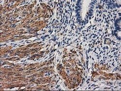 DES Monoclonal Antibody (OTI4G1), TrueMAB , OriGene 30 &mu;L; Unconjugated:Antibodies,