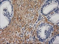 DES Monoclonal Antibody (OTI4G1), TrueMAB , OriGene 30 &mu;L; Unconjugated:Antibodies,