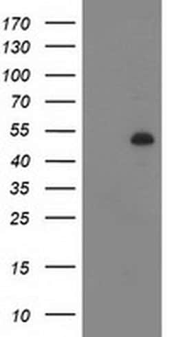 DES Monoclonal Antibody (OTI4G1), TrueMAB , OriGene 30 &mu;L; Unconjugated:Antibodies,