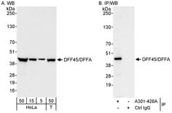 DFF45/DFFA Rabbit anti-Human, Polyclonal, Bethyl Laboratories 100 &mu;l;