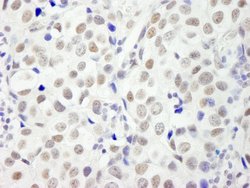 DFF45/DFFA Polyclonal Antibody, Bethyl Laboratories 100 &mu;L; Unconjugated:Antibodies,
