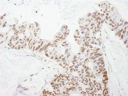 DFF45/DFFA Polyclonal Antibody, Bethyl Laboratories 100 &mu;L; Unconjugated:Antibodies,