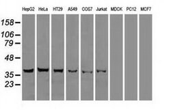 DFF45 Mouse anti-Human, Clone: OTI3F12, liquid, TrueMAB 100 &mu;L; Unconjugated:Antibodies,