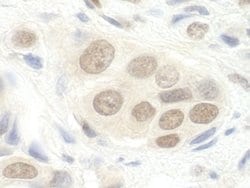 DGCR8 Polyclonal Antibody, Bethyl Laboratories:Antibodies:Primary Antibodies