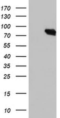 DGKA Monoclonal Antibody (OTI6B3), TrueMAB , OriGene 30 &mu;L; Unconjugated:Antibodies,