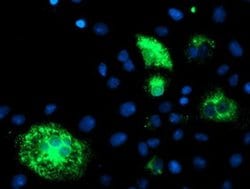 DHFRL1 Monoclonal Antibody (OTI1E2), TrueMAB , OriGene:Antibodies:Primary