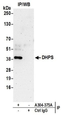 DHPS Rabbit anti-Human, Mouse, Polyclonal, Bethyl Laboratories 10 &mu;L;