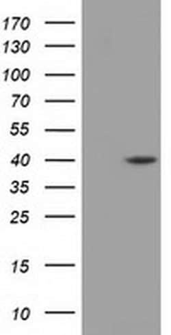 DHPS Monoclonal Antibody (OTI2C9), TrueMAB , OriGene:Antibodies:Primary
