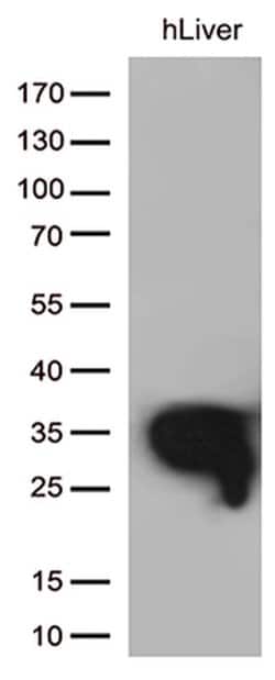 DHRS1 Monoclonal Antibody (OTI4C12), TrueMAB , OriGene:Antibodies:Primary