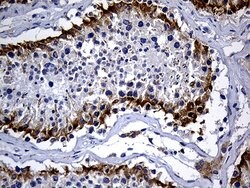 DHRS4L2 Mouse anti-Human, Clone: OTI4A10, lyophilized, TrueMAB 100 &mu;g;