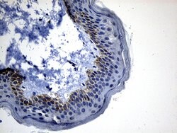 DHRS4L2 Monoclonal Antibody (OTI8A2), TrueMAB , OriGene 100 &mu;L; Unconjugated:Antibodies,