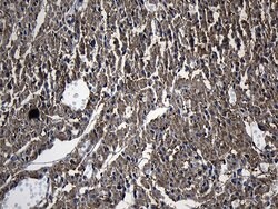 DHRS4L2 Monoclonal Antibody (OTI8A2), TrueMAB , OriGene 100 &mu;L; Unconjugated:Antibodies,