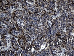 DHRS4L2 Monoclonal Antibody (OTI8A2), TrueMAB , OriGene 100 &mu;L; Unconjugated:Antibodies,