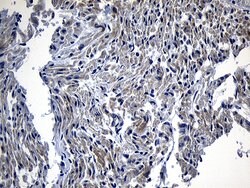 DHRS4L2 Monoclonal Antibody (OTI8D1), TrueMAB , OriGene 100 &mu;L; Unconjugated:Antibodies,