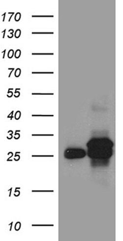 DHRS4L2 Mouse anti-Human, Clone: OTI4A10, lyophilized, TrueMAB 100 &mu;g;