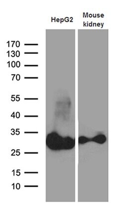 DHRS4L2 Mouse anti-Human, Clone: OTI4A10, lyophilized, TrueMAB 100 &mu;g;