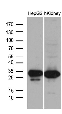 DHRS4L2 Monoclonal Antibody (OTI8A2), TrueMAB , OriGene:Antibodies:Primary