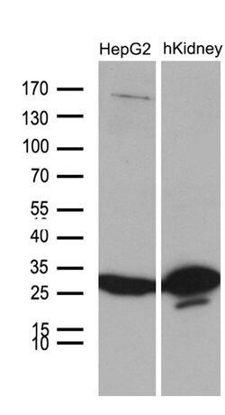DHRS4L2 Monoclonal Antibody (OTI8D1), TrueMAB , OriGene:Antibodies:Primary