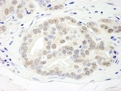 DHX15 Rabbit anti-Human, Polyclonal, Bethyl Laboratories 100 &mu;L; Unconjugated:Antibodies,