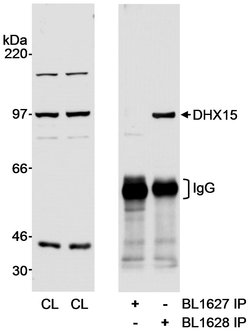 DHX15 Rabbit anti-Human, Polyclonal, Bethyl Laboratories 100 &mu;L; Unconjugated:Antibodies,