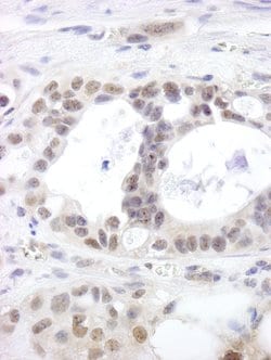 DHX15 Polyclonal Antibody, Bethyl Laboratories 10 &mu;L; Unconjugated:Antibodies,